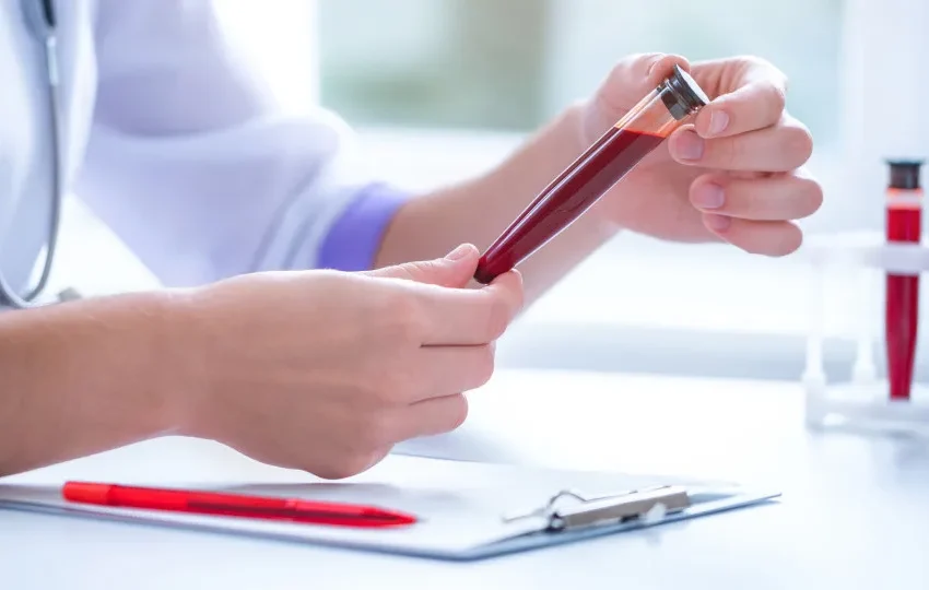 Anvisa busca laboratórios com capacidade de detectar metanol em amostras de sangue