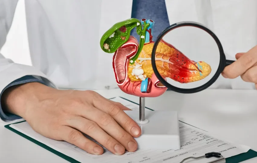  Crescem casos de câncer de pâncreas antes dos 50 anos; aumento é maior entre mulheres