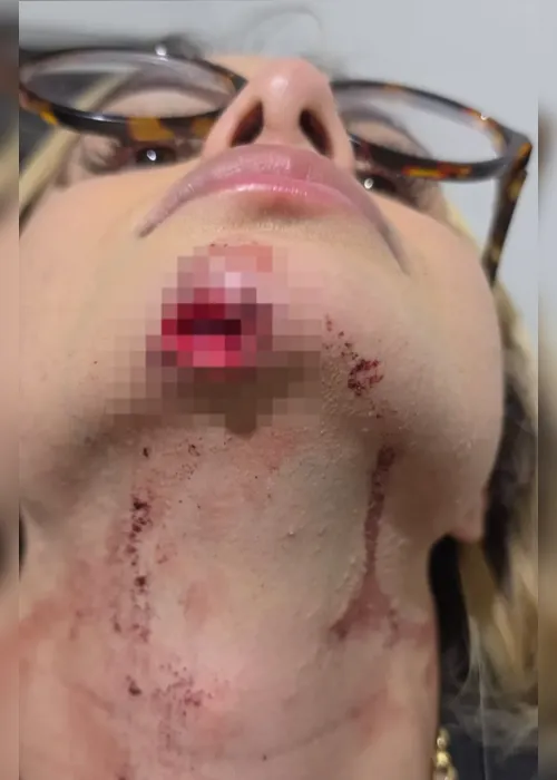 Influencer agredida: veja nota na íntegra de entidade após vítima ser arrastada por ex-companheiro