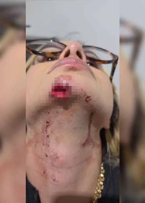 Influenciadora de Maceió relata agressão do ex e diz ter sido arrastada em carro por 100 metros