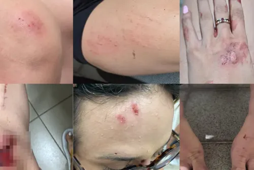 Justiça nega prisão de acusado de agredir influencer em Maceió